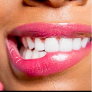 Your Mouth And HIV